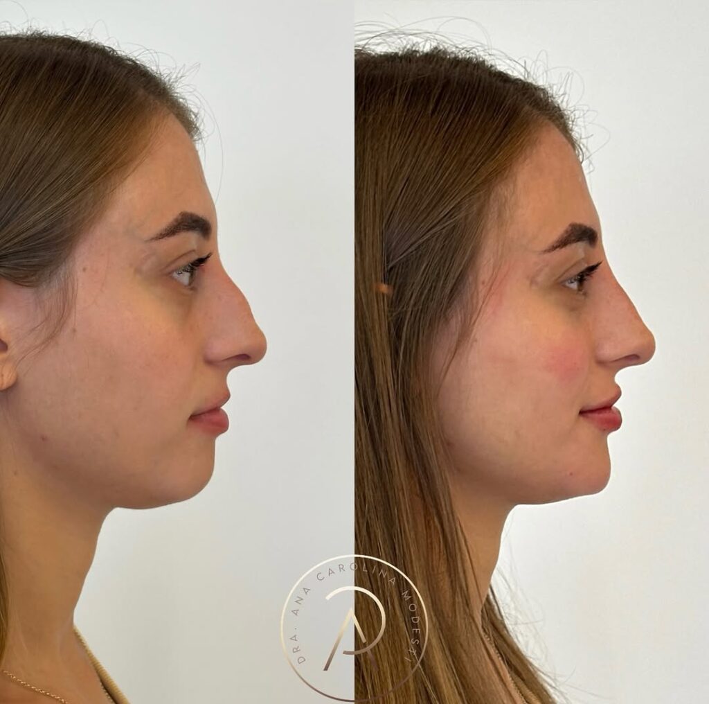 SaveClip.App_481972157_18487617409043656_9093484176744622648_n