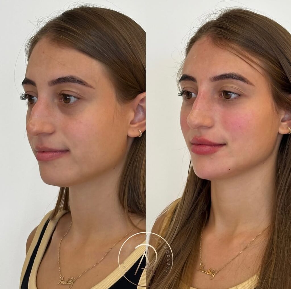 SaveClip.App_482487384_18487617421043656_644471491922296667_n