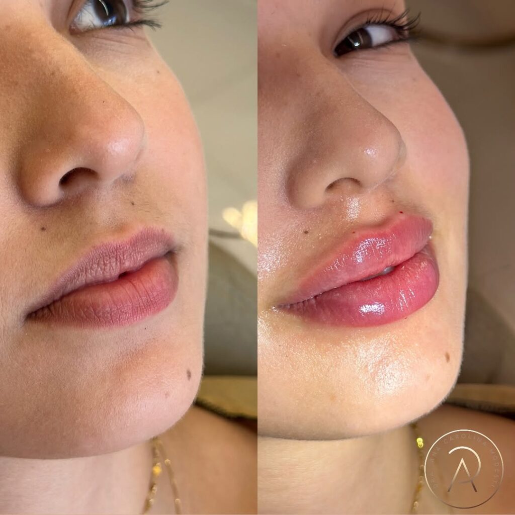 SaveClip.App_485121433_18491948188043656_5999281228483722960_n