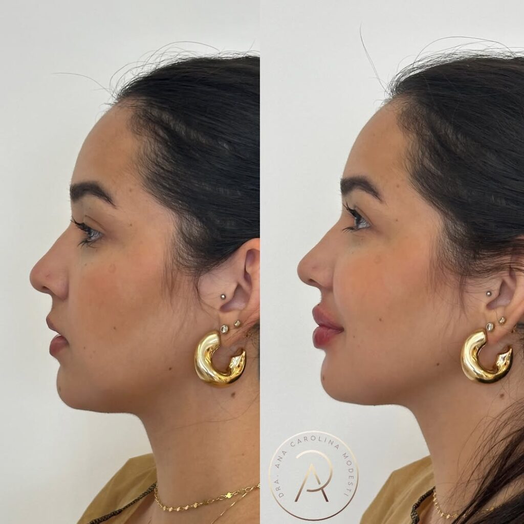 SaveClip.App_485152254_18491948212043656_112748490927233278_n