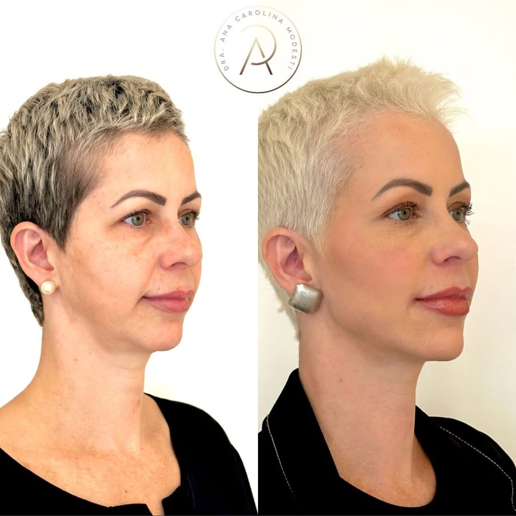 SaveClip.App_496334796_18501804442043656_6533508401378972701_n