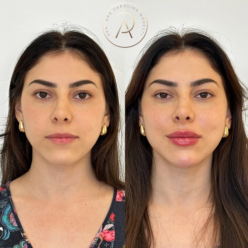 SaveClip.App_499880437_18504272314043656_6803656887316294047_n